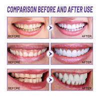 Crème V34 de haute qualité blanchiment en gros pour les soins dentaires pâte de nettoyage des dents Gel de blanchiment des dents à usage domestique gratuit