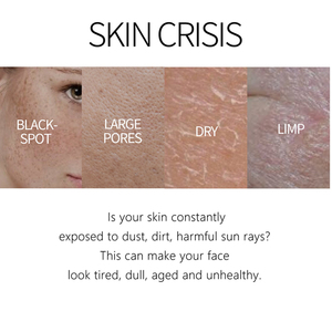 Lanthome 20g kojic acid mặt kem tốt nhất bán Trung Quốc đốm đen loại bỏ da giữ ẩm làm săn chắc làm trắng kem - Product Image 6