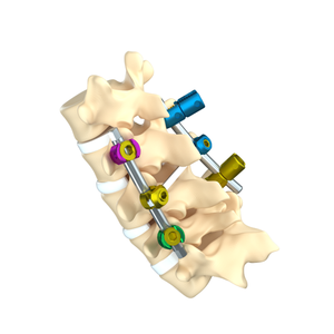 Hoogwaardige titanium implanteerbare kunstorganen COX II voor wervelkolomchirurgie, medisch hulpmiddel klasse III - Product Image 1
