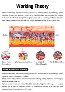 Terbaru 2 dalam 1 peralatan pijat tubuh pneumatik & elektromagnetik terapi kejut - Product Image 6