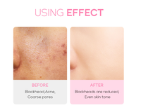 Produits Cosmétiques Coréens en Gros Soins Visage Peau Fleur de Cerisier Masque Facial en Feuille de Boue