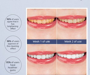 แปรงสี<span class=keywords><strong>ฟัน</strong></span>ไฟฟ้าโซนิคความถี่สูงพร้อมแบตเตอรี่ใช้งานได้ยาวนานและโหมดการทำความสะอาดหลากหลายเพื่อรอยยิ้มที่สดใสอย่างมั่นใจ - Product Image 4