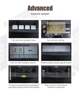 Épilateur laser diode 2026, 3 longueurs d'onde, analyse de la peau 3D, laser diode 3 longueurs d'onde, épilation au laser diode professionnelle - Product Image 6