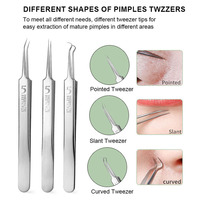Kit professionnel d'extraction de points noirs et d'acné en acier inoxydable – Outil d'élimination des comédons pour le nez et le visage