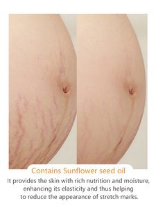 Crème <span class=keywords><strong>Anti</strong></span>-Vergetures <span class=keywords><strong>Grossesse</strong></span> Réparatrice Raffermissante Hydratante Élimination des Cicatrices Soin de la Peau Vente en Gros - Product Image 5