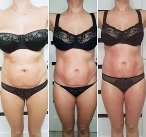 Masajeador Anticelulítico Reafirmante de Piel Rollaction Celulitis, Innovador Masajeador Corporal Reductor 360 Grados Endo BallPhere Rollactive - Product Image 5