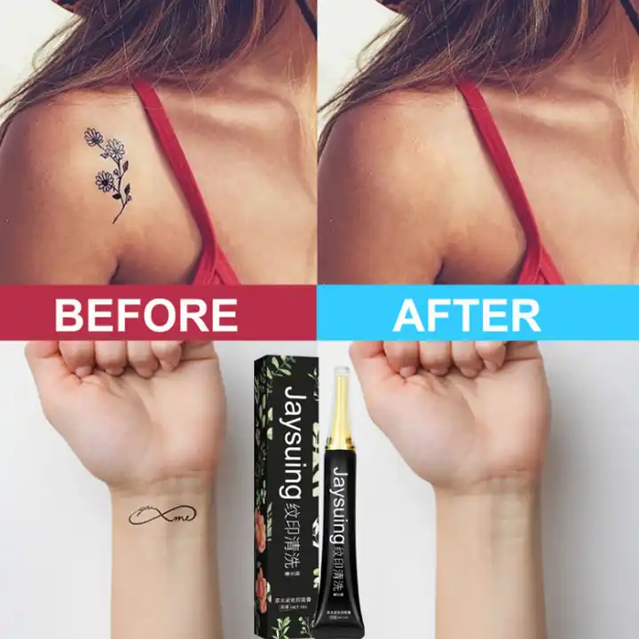 Home Remedy Myths: Does Tattoo Removal Cream Work? - Better Off