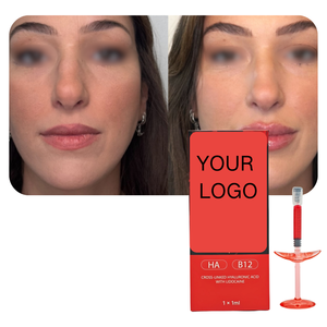 Gel injectable pour les lèvres, sûr et doux, 1 ml, rouge, <span class=keywords><strong>acide</strong></span> <span class=keywords><strong>hyaluronique</strong></span> + vitamine B12, crée un effet naturel de rouge à lèvres, <span class=keywords><strong>prix</strong></span> de gros d'usine - Product Image 3