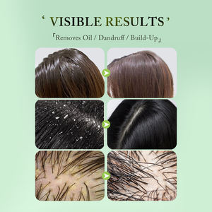 <span class=keywords><strong>Champú</strong></span> y acondicionador para el cabello anticaspa con logotipo personalizado, fábrica Orgainc <span class=keywords><strong>Ayurveda</strong></span>, Limpieza Profunda, Control de aceite, <span class=keywords><strong>champú</strong></span> y acondicionador purificante - Product Image 6