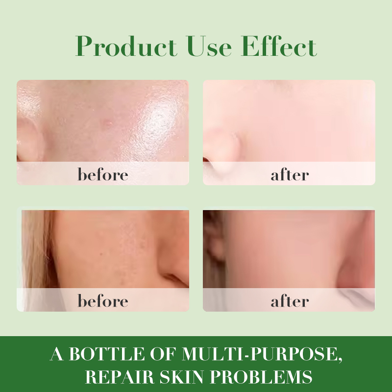 ALCAROL Skin Lightening Smoothing Gel Organic Natural 95% Pure Aloe Vera  Gel for Face and Body| Alibaba.com