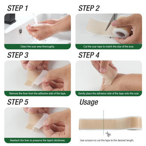 Private Label Litteken Keloïde Bultverwijderingstape Siliconen Littekenplaten Voor Chirurgische Littekens (1.6 "X 60" Roll-1.5M) - Product Image 6