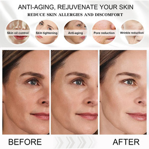 <span class=keywords><strong>Toner</strong></span> de soin du visage blanchissant OEM de marque privée apaisant <span class=keywords><strong>sensible</strong></span> réparant la <span class=keywords><strong>peau</strong></span> endommagée <span class=keywords><strong>Toner</strong></span> au glutathion <span class=keywords><strong>pour</strong></span> le visage - Product Image 4