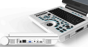 Escáner de Ultrasonido Médico Veterinario Portátil para Aplicaciones Clínicas con Laptop, Máquina de Ultrasonido - Product Image 3