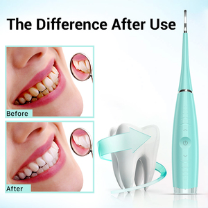 Professionnel Rechargeable Oral Iirrigator Dentaire Électrique Dents Nettoyant <span class=keywords><strong>Hydropulseur</strong></span> - Product Image 3