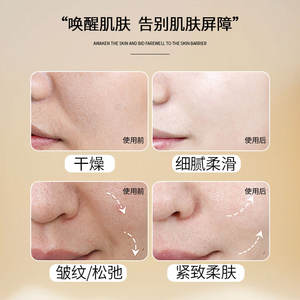 เซรั่มเหลวเลือดขาวสำหรับเอสเซนส์ต่อต้านริ้วรอยสำหรับใบหน้าให้ความชุ่มชื้นต่อต้านริ้วรอยและกระชับ - Product Image 6