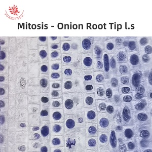 Preparaciones de <span class=keywords><strong>Microscopio</strong></span> de División Celular, Multiplicación de Raíz de Cebolla L.S., Meiosis de Saltamontes Sec. <span class=keywords><strong>Mitosis</strong></span> de Animales Sec. Huevo de Parascaris - Product Image 6
