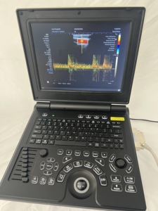 Échographe <span class=keywords><strong>portable</strong></span> pour ordinateur <span class=keywords><strong>portable</strong></span>, système d'échographie diagnostique, échographe couleur <span class=keywords><strong>Doppler</strong></span> 3D/4D - Product Image 3
