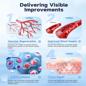 Appareil de thérapie par ondes de choc focalisées, tendance du moment, pour le soulagement de la douleur et la récupération musculaire - Product Image 4