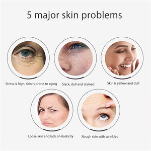 Vaporizador Facial Profesional 2020 para Limpieza Profunda, Spa, Hidratación, Vapor Nano, Iónico, con Logo - Product Image 3