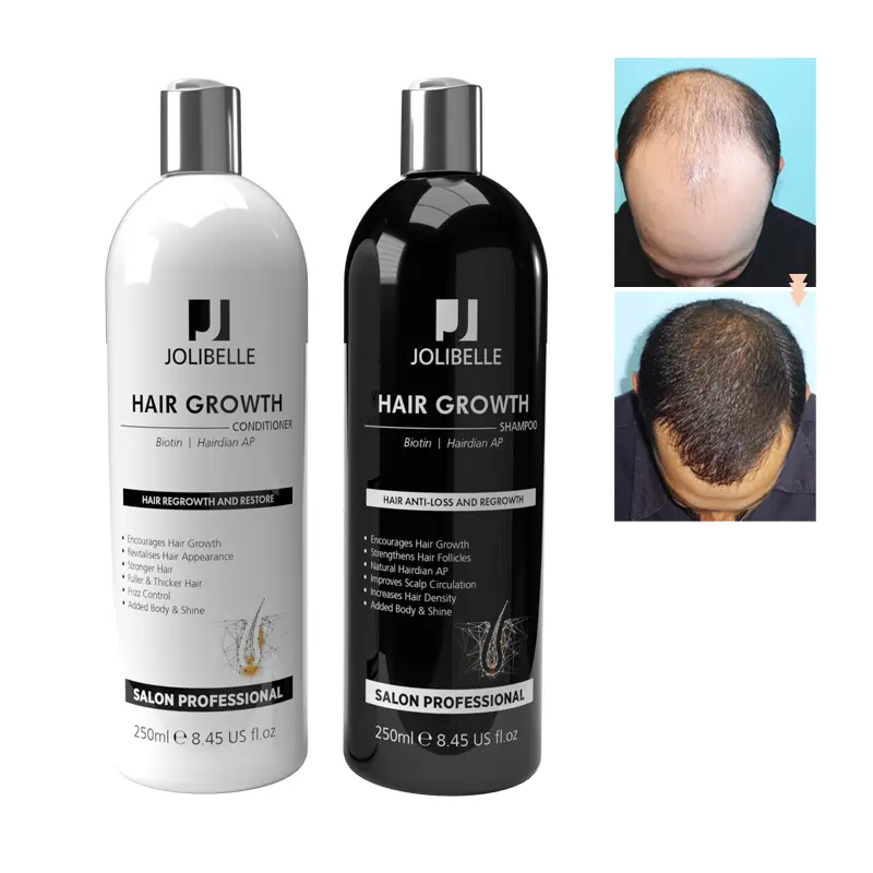 Private Label Best Strengthens Density Organic Biotin Anti Loss Fall Hair Growth Shampoo And Conditioner