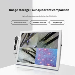 Werkseitige 15-Zoll-High-Definition-Haut-und Haarana ly seger ät 4-Gitter-Kopf-Trichoskop für den Schönheits salon - Product Image 2