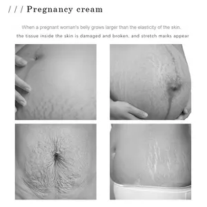 Crème corporelle <span class=keywords><strong>anti</strong></span>-vergetures à la mangue 40g, crème biologique pour la récupération post-partum, élimination des vergetures, crème pour femmes enceintes - Product Image 2