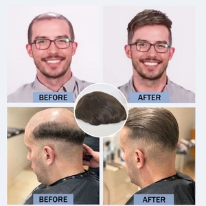 FH #1 Pu + lace + mono French Topper pour homme Unité de cheveux humains Natural Wave 8x10 Inch Base Curly Replacement System - Product Image 6