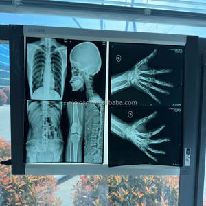 Klinik ve hastane radyoloji malzemeleri için 11 "* 14" tıbbi termal <span class=keywords><strong>x</strong></span>-<span class=keywords><strong>ray</strong></span> filmi | <span class=keywords><strong>Dicom</strong></span>-uyumlu medikal <span class=keywords><strong>Film</strong></span> - Product Image 6