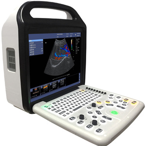Échographe Doppler Couleur Vétérinaire VS-P50 Haute <span class=keywords><strong>Définition</strong></span> Numérique pour Bétail d'Élevage et Animaux de Compagnie - Product Image 3