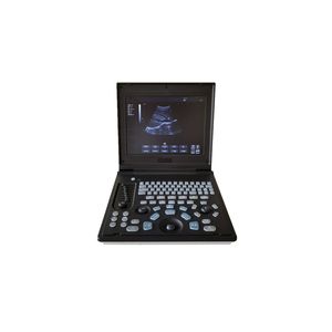 CHINCAN CK-2288Z 노트북 흑백 초음파 진단 시스템 초음파 스캐너 기계 프로브와 함께 - Product Image 2