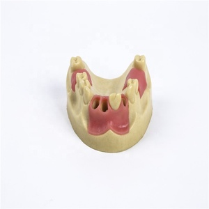 การสอนเข่า implant Model - Product Image 2