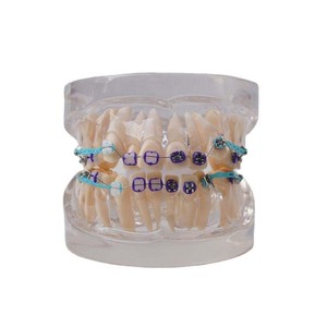 Modèle de dents dentaires/modèle orthodontique <span class=keywords><strong>dentaire</strong></span> avec supports métalliques - Product Image 1