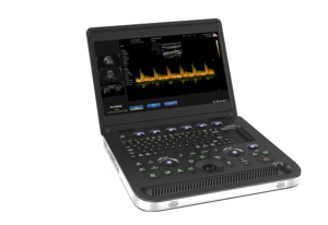 SN10Pro Portable Ultrasound Machine 15.6" HD Display Windows 7 THI <strong>Imaging</strong> 3D Option 4 Hours Battery IMT Auto Medical Equipment - Product Image 3