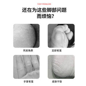 Baiyi Foot <b>File</b> 8-Piece Pedicure Set Stainless Steel For Home Use Dead Skin Callus Remover - Product Image 1