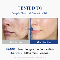 Scrub Wajah Gliserol Blueberry Pengelupasan Kulit Lembut Vitamin C Pemutih dan Melembapkan Pencerah Kualitas Kulit Pembersih