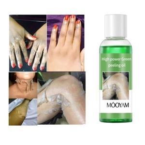Óleo de peeling verde OEM de alta potência para clareamento da pele, óleo de peeling para remoção de cicatrizes e estrias, marca própria, 100ml - Product Image 1