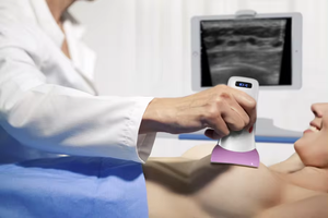 Ultrasonido <span class=keywords><strong>Doppler</strong></span> de Palma lineal ultra ancho inalámbrico de bolsillo para examen de músculos abdominales de cadera y pecho, 1, 2, 2 - Product Image 4