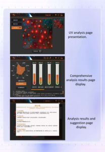Máquina de Hidroterapia de Oxígeno 11 en 1 de Alta Venta para el Cuidado Facial, Rejuvenecimiento de la Piel Antienvejecimiento, Dermoabrasión con Analizador de Piel y Cuero Cabelludo con IA - Product Image 4