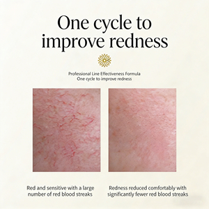 <span class=keywords><strong>Crema</strong></span> Rigenerante per <span class=keywords><strong>Pelle</strong></span> <span class=keywords><strong>Sensibile</strong></span>, Riparazione Barriera Cutanea, Lenitiva, Anti-Arrossamento, Idratante, <span class=keywords><strong>Crema</strong></span> Riparatrice OEM - Product Image 4