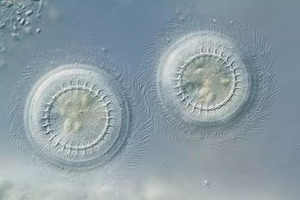 Beste Parasiet Detox Natuurveiligheid Geen Schadelijke Residu Blokkeert Zenuwgeleiding Energiemetabolisme Van Parasieten - Product Image 5