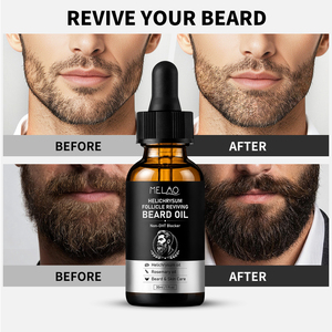Huile Essentielle de Barbier à base d'Herbe de Helichryse pour Hommes – Hydratant Non Collant pour une Barbe Dynamique et Brillante – Huile à Barbe - Product Image 5