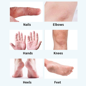 Crème réparatrice blanchissante <span class=keywords><strong>à</strong></span> l'urée de marque privée masque exfoliant pour les pieds <span class=keywords><strong>et</strong></span> les mains - Product Image 4