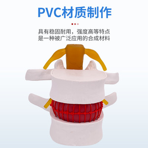 Simulation pédagogique du modèle de hernie discale lombaire humaine, démonstration de mesure de la pression vertébrale, vertébral - Product Image 2