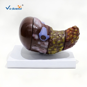 แบบจำลองทางกายวิภาคของตับที่เป็นโรค 4 ขั้นตอน ทำจาก PVC สำหรับการฝึกอบรมทางวิทยาศาสตร์การแพทย์ในโรงพยาบาล โดย VIC-SCIENCE - Product Image 4