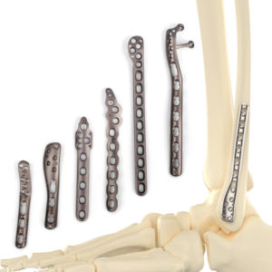 CANWELL Distal Lateral <span class=keywords><strong>Fibular</strong></span> Locking Plate Implan Ortopedi Pelat Trauma Titanium untuk Fragmen Kecil 2.7 3.5 Pelat <span class=keywords><strong>Fibular</strong></span> CE - Product Image 3
