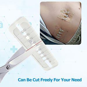 Vendajes para cierre de heridas, tiras de cierre de heridas, alternativa a los puntos para pequeños cortes y laceraciones - Product Image 6