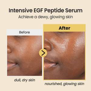 [SAMPLE] Suero Intensivo con Péptidos EGF 50ml, Suero Facial Coreano para Hidratación, Reafirmación y Reducción de Arrugas - Product Image 4