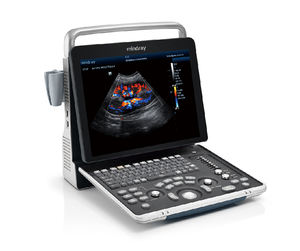 Sistema de Ultrasonido Veterinario Portátil <span class=keywords><strong>Mindray</strong></span> Z60, Máquina Ecográfica para Diagnóstico Animal en Venta - Product Image 5