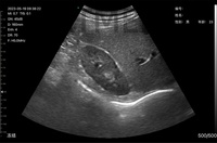 Escáner de Ultrasonido Portátil Intercambiable 6 en 1 C8 para Cardiología, Abdomen, Vasos Sanguíneos, Uso Humano y Veterinario, Máquina de Ultrasonido de Mano