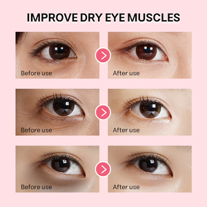 Mascarilla para <span class=keywords><strong>Ojos</strong></span> PDRN OEM con ADN de Salmón, Hexapéptido 8, Cafeína, para Ojeras, Bolsas y Antienvejecimiento, en Stock, Envío Rápido, Venta al Por Mayor - Product Image 6